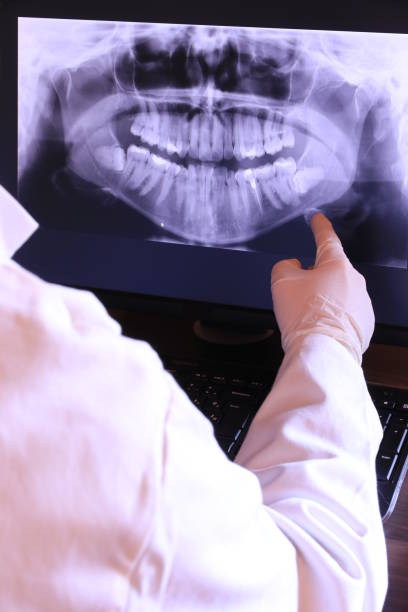 Best Emergency Care for Gum Disease in Glen Rock, PA