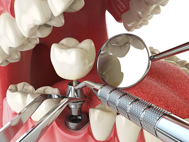 Best Walk-In Emergency Dental Services in Glen Rock, PA