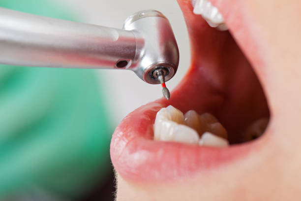 Best Emergency Cosmetic Dentistry (e.g., broken veneers) in Glen Rock, PA
